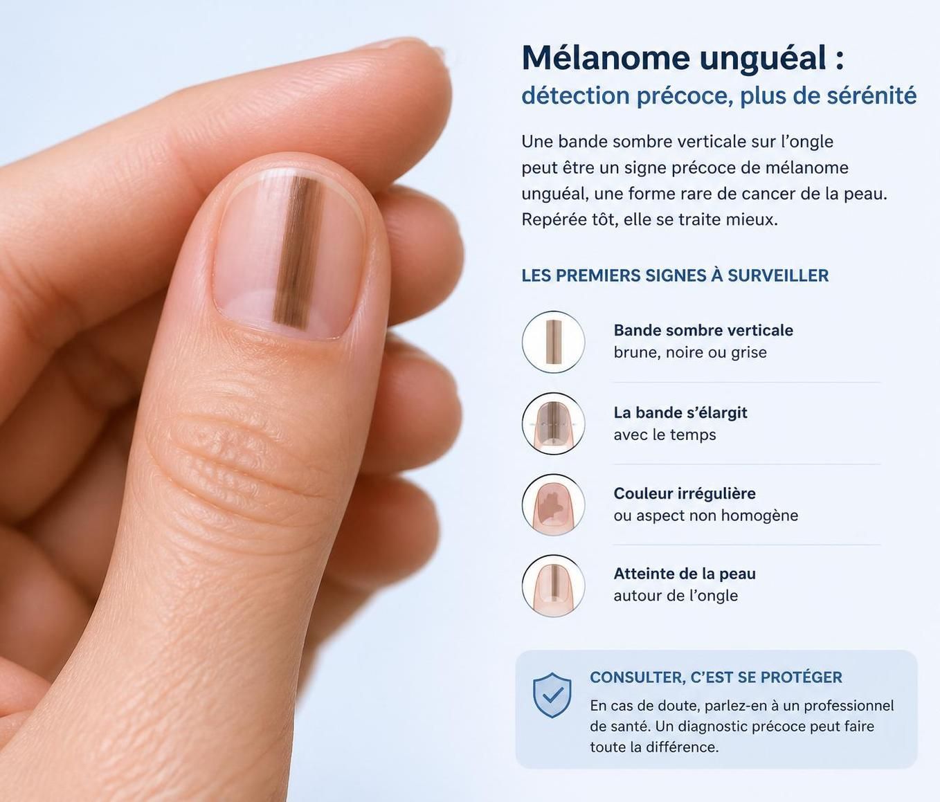 découvrez comment reconnaître rapidement les premiers signes du mélanome unguéal pour agir efficacement et préserver votre santé.